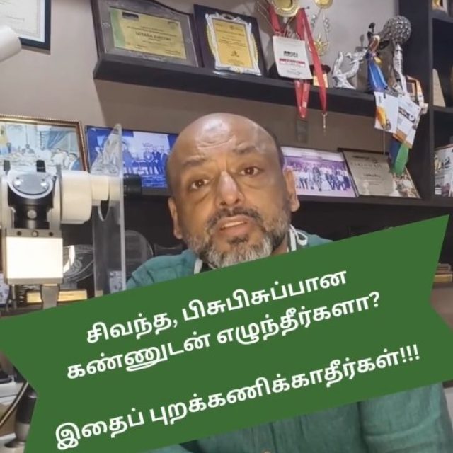 🚨 கண் சிவப்பா? ஒரு பேருக்கு வந்தால்… முழு குடும்பத்துக்கும் பரவலாம்! 👁️

காலை எழுந்ததும் கண் சிவப்பு, ஒட்டியதாக அல்லது நீர் வடிகிறதா? அதை அலட்சியப்படுத்தாதீர்கள்.
இது Conjunctivitis (Eye Flu) ஆக இருக்கலாம்—மிக வேகமாக பரவும் infection.

⚠️ கண் சிவப்பு • நீர்க்கசிவு • ஒட்டும் discharge • அரிப்பு
🛑 பார்ப்பதால் பரவாது—கைகள், towel, pillow மூலம்தான் பரவும்
💧 சுத்தமாக இருங்கள், கண்களைத் தொடாதீர்கள்

❌ Self-medication செய்யாதீர்கள்
👨‍⚕️ சரியான நேரத்தில் மருத்துவரை அணுகுவது மிக முக்கியம்

📞 Call அல்லது website மூலம் appointment book செய்யலாம்
🌐 Emergencyக்கு online consultation available

📌 இதை save செய்து உங்கள் குடும்பத்துடன் share செய்யுங்கள்—awareness தான் பாதுகாப்பு!

#EyeFlu #Conjunctivitis #RedEye #EyeInfection #EyeCare EyeHealth Ophthalmology DoctorReels HealthAwareness PreventInfection StaySafe HealthyEyes MedicalReels ViralReels TamilReels TamilHealth ChennaiDoctors EyeCareTips ConsultDoctor PublicHealth InstaHealth